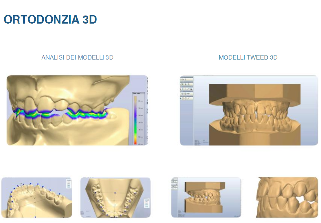 齿科3D打印